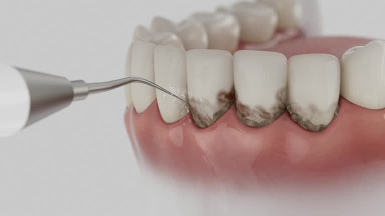 Reliable Dental Implants contractor in Portage, IN by Smile Center Dentistry